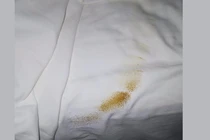 Phẫn nộ cặp vợ chồng thuê khách sạn 5 sao lại còn “phóng uế” lên giường