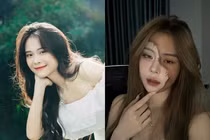 Hot TikToker 7,2 triệu follow vướng nghi vấn phẫu thuật thẩm mỹ