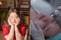 Trúc Anh (Mắt Biếc) hậu nâng cơ mặt, nhan sắc ra sao?