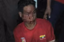 Những bê bối đáng quên nhất tại SEA Games 29 