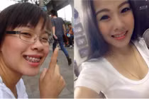 Nhờ phẫu thuật thẩm mỹ cô nàng răng hô hóa hot girl