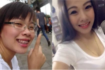 Nhờ phẫu thuật thẩm mỹ cô nàng răng hô hóa hot girl