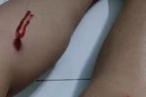 Đang ngồi, cặp vợ chồng bị nhóm thanh niên ném pháo vào người 