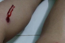 Đang ngồi, cặp vợ chồng bị nhóm thanh niên ném pháo vào người 