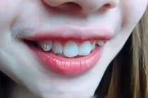 Kẻ khóc người cười theo trào lưu khoe môi tự nhiên