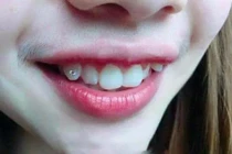 Kẻ khóc người cười theo trào lưu khoe môi tự nhiên