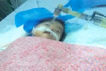 Chủ tịch Hà Nội yêu cầu Công an điều tra vụ bé 8 tháng tuổi tử vong do bị tiêm nhầm