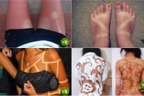 Ảnh cơ thể loang lổ vì chống nắng không đều cười vỡ bụng