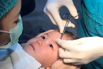 Bé gái quyết không khóc khi được bác sĩ khâu vết thương