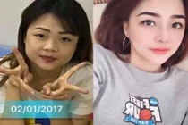 9X mắt một mí xinh như hot girl sau khi "dao kéo"