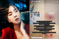 Sức khỏe MC Mai Ngọc ra sao sau 1 tuần vào viện?