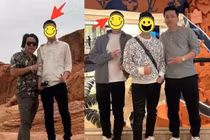 Khoa Pug tự tay đăng ảnh trước và sau khi kéo chân 5 tỷ