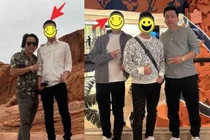 Khoa Pug tự tay đăng ảnh trước và sau khi kéo chân 5 tỷ