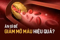 Video: 5 thứ được ví như "bùa hộ mệnh" của người bị mỡ máu cao