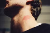 Trai trẻ sùi bọt mép, mất mạng sau pha “mút cổ” với người yêu