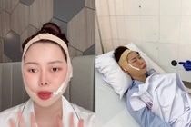 "Chị Google" Việt Phương Thoa biến chứng thẩm mỹ sau 6 năm