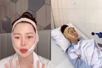 "Chị Google" Việt Phương Thoa biến chứng thẩm mỹ sau 6 năm