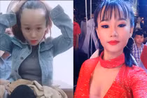 1001 nỗi khổ bất tận của girl xinh sở hữu vầng trán sân bay "lồng lộng"