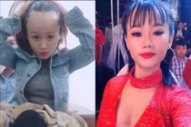 1001 nỗi khổ bất tận của girl xinh sở hữu vầng trán sân bay "lồng lộng"