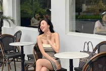 Sửa điểm này trên gương mặt, cựu nữ tiếp viên hàng không ân hận