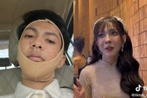 Chi tiền tỷ phẫu thuật, nhan sắc hiện tượng mạng giả gái ra sao?