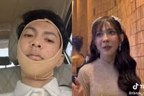 Chi tiền tỷ phẫu thuật, nhan sắc hiện tượng mạng giả gái ra sao?