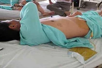 Ghen tuông, vợ nổi cơn giận cắt phăng “của quý” chồng