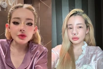 Ngân 98 tiết lộ phải nhập viện... do nhiễm trùng nặng