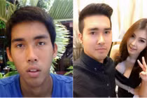 Trai quê xấu xí lột xác thành hot boy dao kéo 