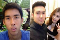 Trai quê xấu xí lột xác thành hot boy dao kéo 