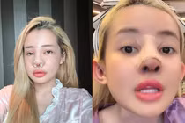 "Nghiện" phẫu thuật thẩm mỹ, Ngân 98 lại chuẩn bị "đập đi xây lại"