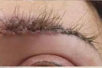 Cấy lông mày người phụ nữ nhận cái kết đáng sợ