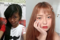 Lộ ảnh đen như than, nữ sinh tiết lộ dao kéo đúng “1 chỗ“