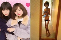 Cô gái trẻ thân hình gầy xác ve vì bị ông nội bỏ đói 