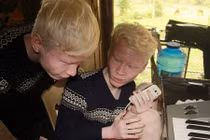 Xúc động ước mơ làm ca sỹ của anh em sinh đôi bị bạch tạng