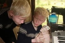 Xúc động ước mơ làm ca sỹ của anh em sinh đôi bị bạch tạng