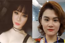 Khuôn mặt trước phẫu thuật gây sốc của DJ Bến Tre