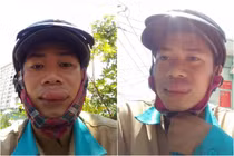 Đi sửa mạng, anh chàng môi sưng tều vì gặp phải "đối thủ" này