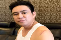 Nữ bác sĩ chuyển tiền cho người chém ông Chiêm Quốc Thái là ai?