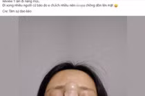 Cô gái gây hãi hùng khi nhìn thành quả của màn nâng mũi