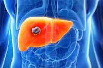 Bài tập dưỡng gan tăng cường sức khỏe