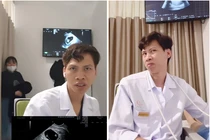 Bác sĩ siêu âm thai hot TikTok gây chú ý với biểu cảm 