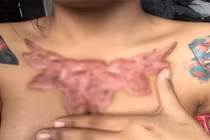 Cách xóa hình xăm ghê rợn của cô gái bị "bồ đá"