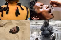 Rùng mình với những cách chữa bệnh ''siêu'' quái dị