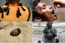 Rùng mình với những cách chữa bệnh ''siêu'' quái dị