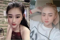 Hot trend môi cánh én biến dạng, chị em nghiện "dao kéo" rần rần chạy theo 