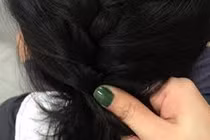 Clip: Sốc cảnh hàng trăm con chấy rơi khỏi đầu bé gái sau 1 lần chải