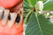 Lá bàng đun nóng: Hiệu quả từ đau răng, nhiệt miệng đến... viêm vùng kín 