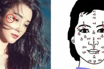 7 nốt ruồi vượng tướng tu 10 đời mới có, đừng dại tẩy đi 