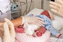 Bé gái ở Hải Phòng vừa ra đời toàn thân đỏ tía